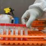 vaksin astrazeneca covid-19 pfizer moderna sinovac