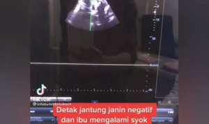 Viral Janin di dalam Bumil Meninggal Akibat Minum Rumput Fatimah, Ini Penjelaan Ahli