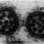 Virus Covid-19 Varian Delta yang ditemukan di India jenis nama virus terus mengalami mutasi dan memiliki varian baru. keberadaan virus tidak lepas dari prilaku buruk hidup manusia.