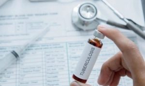 Waspada! Anak-Anak Indonesia Beresiko Tertular TBC Ilustrasi tuberculosis (TBC). (Shutterstock)