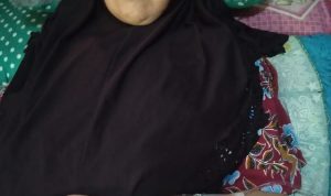 Menderita Tumor Saraf, Ibu Paruh Baya di Garut Butuh Uluran Tangan
