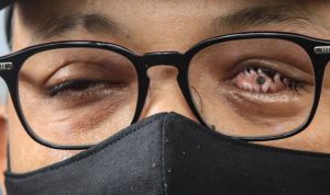 novel baswedan mantan penyidik kpk perjuangan lawan korupsi youtuber