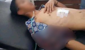 Kesal Sering Dibully, Siswa SMP Tusuk Temannya bullying