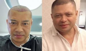 Unggah Foto Saat Botak, Anang Hermansyah Disebut Mirip Raul Lemos