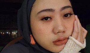 Aya Canina, mantan vokalis band Amigdala yang akhirnya buka suara terkait kekerasan yang dialaminya. (ist)