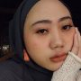 Aya Canina, mantan vokalis band Amigdala yang akhirnya buka suara terkait kekerasan yang dialaminya. (ist)