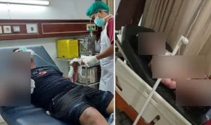 Kondisi Korban yang mengalami luka bakar serius saat menjalani perawatan di ruang ICU RS karena menjadi korban oknum polisi yang nekad bakar pacar karena tak mau diputus. Foto: Ist via Sumeks