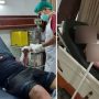 Kondisi Korban yang mengalami luka bakar serius saat menjalani perawatan di ruang ICU RS karena menjadi korban oknum polisi yang nekad bakar pacar karena tak mau diputus. Foto: Ist via Sumeks