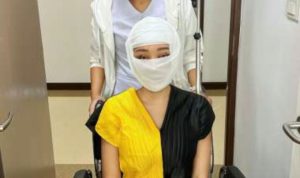Posting Wajah Diperban, Lucinta Luna Mau Unboxing Kepala, ini Maksudnya