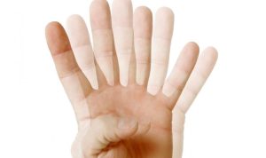 Apa itu Diplopia yang Dialami Marc Marquez? apa itu diplopia?