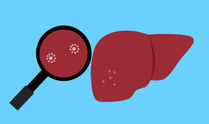 Ilustrasi: Virus Hepatitis misterius (Pixabay)