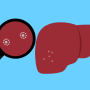 Ilustrasi: Virus Hepatitis misterius (Pixabay)