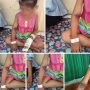 Tangan seorang bocah mengalami lebam seusai di rawat di RS. (tangkapan layar facebook)