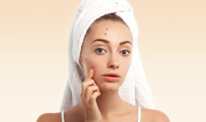 Manfaat Lidah Buaya untuk Meredakan Jerawat, Serta Cara Penggunaannya Manfaat Lidah Buaya untuk Meredakan Jerawat, Serta Cara Penggunaannya