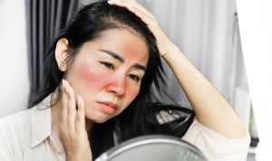 Jangan Diabaikan, ini Tanda-tanda Kulit Mulai Rusak Karena Merkuri Ilustrasi kulit wajah rusak karena terpapar merkuri. (pixabay)