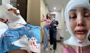 Kurang Puas, Lucinta Luna Kembali Jalani Operasi Hilangkan Suara Khodam Artis Transgender Lucinta Luna kembali melakukan operasi untuk menghilangkan suara Prianya.
