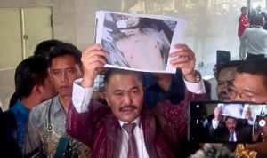 Hasil Autopsi Ulang Jenazah Brigadir J, Kamaruddin: Ada Tembakan dari Kepala Belakang hingga Tembus ke Bagian Hidung