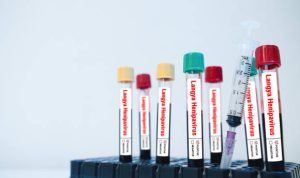 Ilustrasi hasil tes Virus Langya, yang kini mulai diwaspadai menjadi perhatian dunia