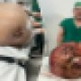foto tumor besar yang berhasil diangkat oleh tim dokter kini viral di media sosial. (Dr. Glaucio Boechat-Facebook)