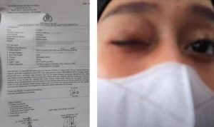 Miris! Lesti Kejora Mengaku Dicekik dan Dibanting Seperti Pemain UFC