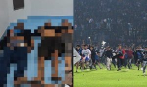 Terus Bertambah, Korban Kerusuhan di Kanjuruhan Kini Sampai 180 Orang Terus Bertambah, Korban Kerusuhan di Kanjuruhan Kini Sampai 180 Orang