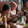 Bayi Kembar Siam, Bayi Kembar Siam, Bayi, Kembar Siang, Kabupaten Bandung Barat, Bupati Bandung Barat, Henky Kurniawan