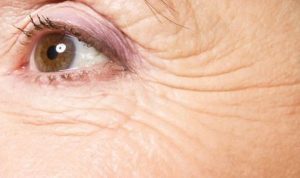 Atasi Kerutan Wajah!, Berikut Daftar Makanannya (sumber: tangkapan layar website Grid.ID)