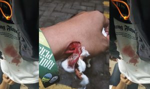 Bobotoh Persib Dibacok dan Bus Dilempari Batu Diduga oleh Oknum UPCS
