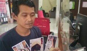 Perawat Lalai! Berniat Potong Selang Infus Malah Potong Jari Bayi
