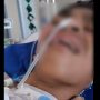 David Ozora Mulai Sadarkan Diri, Masih Mengerang Kesakitan