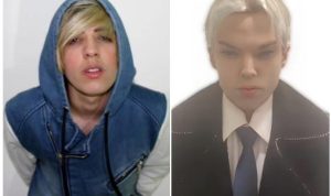 Colucci sebelum operasi (kiri) dan sesudah operasi (kanan) agar mirip Jimin BTS.