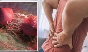 8 Obat Prostat Alami Paling Ampuh Tanpa Operasi 8 Obat Prostat Alami Tanpa Operasi yang Paling Ampuh