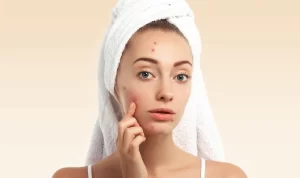 Bagaimana Cara Menghilangkan Jerawat di Wajah? Coba 5 Bahan Alami Ini