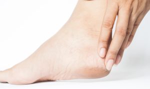Ini Cara Campuh Atasi Kaki Pecah-Pecah dan Kering