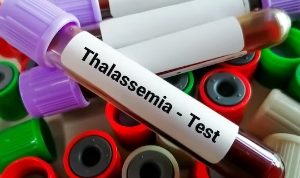 Apa itu Thalasemia, Kenapa Penderitanya Harus Transfusi Darah seumur Hidup? Apa itu thalasemia, temukan seluruh informasinya.