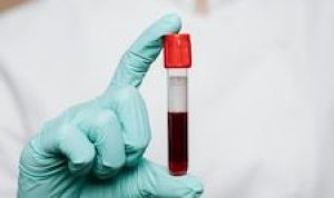 Thalasemia Penyakit Darah yang Perlu Diketahui