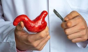 Operasi Bariatrik: Pengertian, Manfaat, dan Pertimbangan Resiko