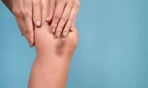Penyebab Memar Tanpa Sebab, Yuk Simak di Sini!
