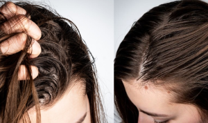 Rambut Berminyak? Tips Cara untuk Merawat Rambut Berminyak Tips Cara untuk Merawat Rambut Berminyak