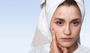 7 Tips Ampuh Merawat Wajah agar Bebas Jerawat!
