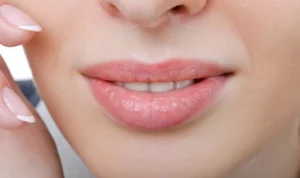 8 Cara Ampuh Mengatasi Bibir Kering dan Pecah-Pecah 8 Cara Ampuh Mengatasi Bibir Kering dan Pecah-Pecah