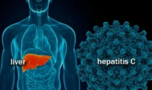 Ilustrasi. Direktur Pascasarjana Universitas YARSI, Prof Tjandra Yoga Aditama meminta pengendalian penyakit hepatitis melalui UU Kesehatan. ANTARA/HO/RSUD Kota Bogor.
