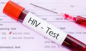 Pria Swiss Berhasil Sembuh dari HIV dengan Terapi Kanker Darah