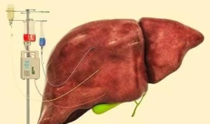 Jenis-jenis Hepatitis dan Pentingnya Perangi Penyakit Berbahaya