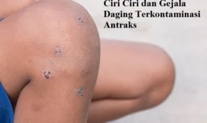 Ciri-ciri dan gejala yang perlu di perhatikan untuk mendeteksi daging terkontaminasi antraks