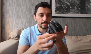 Viral di TikTok Jari Menghitam dan Membeku 'Frostbite' akibat Cuaca Dingin, Ini Penjelasannya