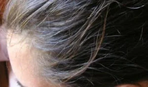 Masih Muda Sudah Ubanan? Ini Dia Penyebabnya!