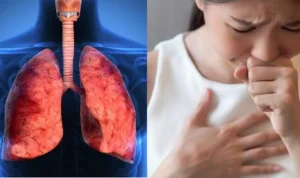 Alasan Kenapa Batuk Tak Kunjung Sembuh