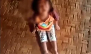 Puskesmas Cidolog, Sukabumi, Jawa Barat ungkap kondisi anak balita yang dianiaya ayah kandung hingga alami trauma.