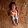 Puskesmas Cidolog, Sukabumi, Jawa Barat ungkap kondisi anak balita yang dianiaya ayah kandung hingga alami trauma.